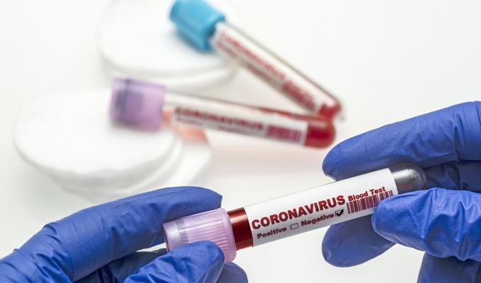 Про стан захворюваності населення Старобільского району на covid-19 Про стан захворюваності населення Старобільского району на covid-19