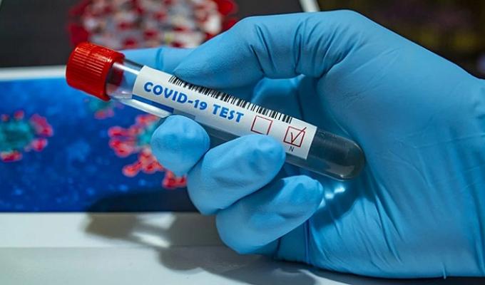 Стан захворюваності населення Старобільського району на COVID-19 (Інфографіка) Стан захворюваності населення Старобільського району на COVID-19 (Інфографіка)