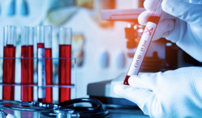 Лабораторно підтверджено 27 нових випадків COVID-19 в області Лабораторно підтверджено 27 нових випадків COVID-19 в області
