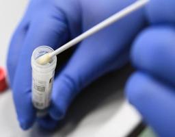 Лабораторно підтверджено 164 нових випадки COVID-19 в області. Ще вісім хворих померли від ускладнень 