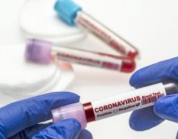 Про стан захворюваності населення Старобільского району на covid-19 