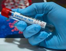 Стан захворюваності населення Старобільського району на COVID-19  (Інфографіка)