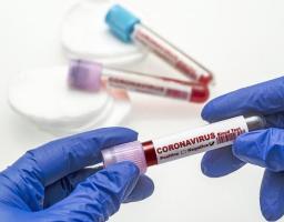 Cтан захворюваності населення старобільского району на covid-19