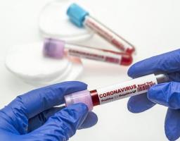 Про стан захворюваності населення Старобільского району на covid-19 на 19 квітня 2021