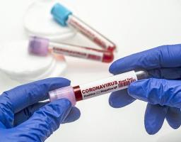 Про стан захворюваності населення старобільского району на covid-19 на 9 квітня 2021 року