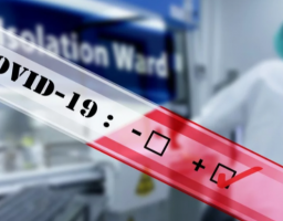 Лабораторно підтверджено 123 нових випадки COVID-19 в області. Одужали ще 292 особи 